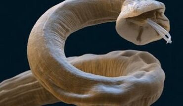 Parasita Ascaris no corpo humano