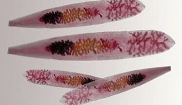 Parasitas Opisthorchis no corpo humano