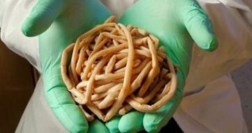 parasitas extraídos do corpo humano