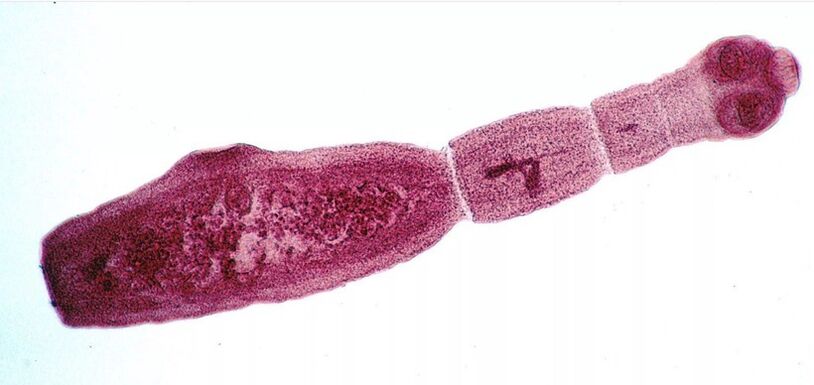Echinococcus é um dos parasitas mais perigosos para humanos