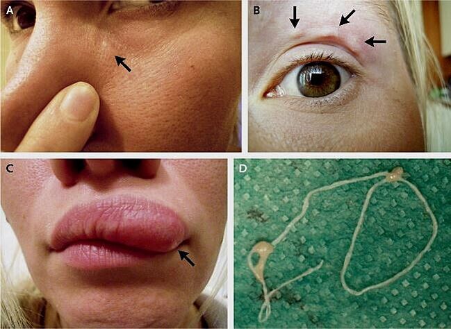 As principais manifestações da dirofilariose no rosto