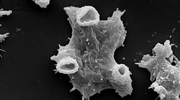 Negleria fowlera é um parasita protozoário perigoso para a vida humana. 