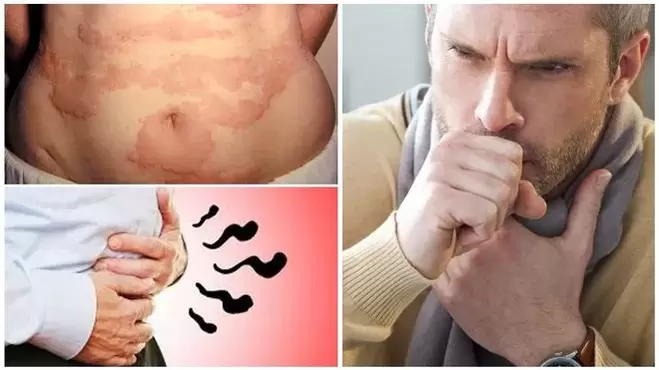 Alergias, tosse e inchaço são sinais de danos ao corpo por vermes