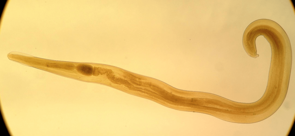 Pinworm é um parasita comum entre crianças. 
