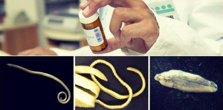 Tipos de vermes e um método medicinal para se livrar deles